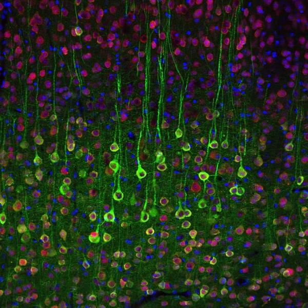 Calcium imaging of pyramidal cells